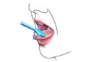 brushing the tongue - proper way of brushing the tongue