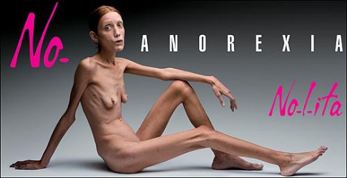 Anorexia Eating Disorder - Stop Eating Disorder Now