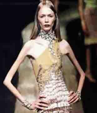 Anorexia Eating Disorder 2 - Anorexia Eating Disorder