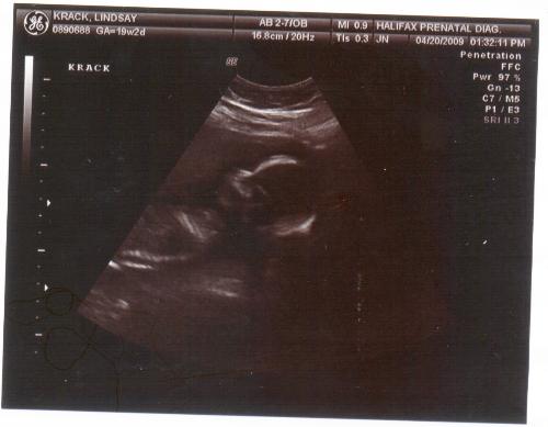 My unborn son - 19 weeks