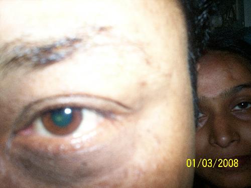 an aggressive eye of a person - this is a picture of an eye of a person.