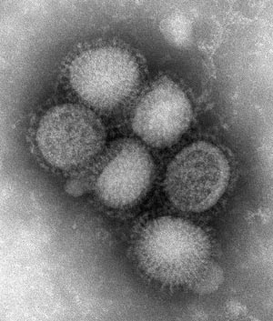 Swine Flu - Microscopic view of Influenza A (H1N1), "Swine Flu."