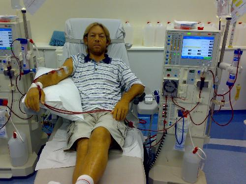 Beertjie on dialysis - This is me on connected to the dialysis machine. Treatment is three times a week for four hours. It is not fun so look after you health.