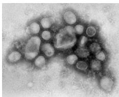 Swine flu germs - This is the germs that cause the swine flu sickness. My suggestion would be to wash your hands as often as possible.