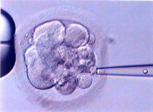 Infertility, IVF, treatments - Infertility egg donation, treatments