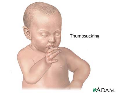 Thumbsucking - How can we stop it?