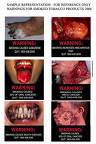 Ew - Do you want to look like this? Quit smoking today.