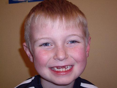 step brother - This is a picture of my step brother and some of the teeth he has lost. It was funny becaus ehe was soo scared that he lost them and thought that he did something wrong and that he would get into trouble.