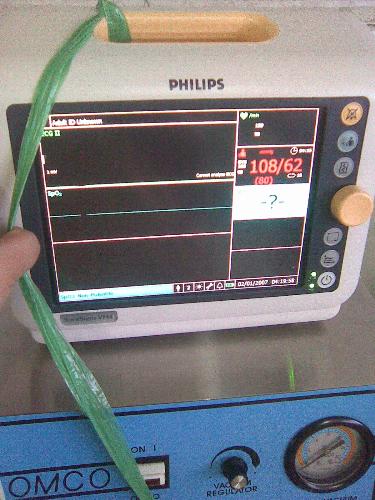 cardiac monitor - this is for the vital signs of patients