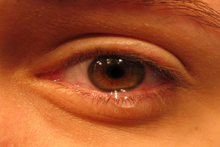 eye with tears - Closeup of eye with tears