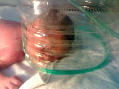 My Little Angel - This picture was taken, a minute after she came. She was a premature baby, thats why she is in an incuvator and the helmet type in her head was her oxygen support.