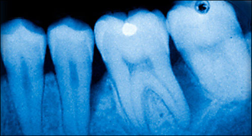 Teeth... - Teeth... Teeth... - Teeth...