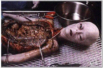 Alien Autopsy - click for information - MI6/CIA ’non-appropriated funds’ is being used to fund government and military projects classified ‘Above top secret’.  These operations include a huge worldwide UFO cover up and the building and maintaining of deep underground military bases (D.U.M.B.S).  There are many of these bases worldwide but here is small list.  - Dulce in New Mexico - Brecon Beacons in Wales - Los Alamos in Mexico - Pine Gap in Australia - The Snowy mountains in Australia - The Nyala range in Africa - West of Kindu in Africa - Next to the Libyan border in Egypt - Mount Blanc in Switzerland - Narvik in Scandinavia - Gottland island in Sweden and many other places. These projects are being run by a secret, unelected international governing body connected to the U.N.