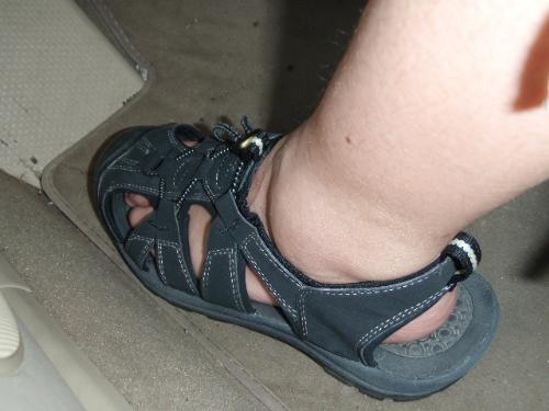 Swollen ankle - Both of my ankles are this swollen