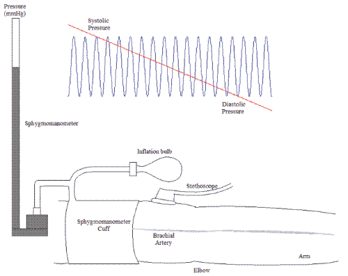 sphygmomanometer - How to measure blood pressure using a sphygmomanometer.