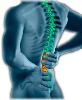 Back Pain - Lower Back pain,Sore back,Lumbar back pain,vertabrae pain,spine pain