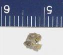 kidney stone is awful  - When you suffer from a kidney stone, it causes you a lot of pain. 