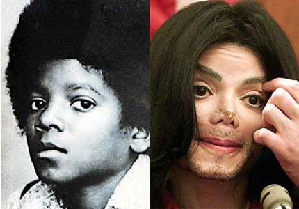 jacko - it's about jacko when he was child and when he get surgery