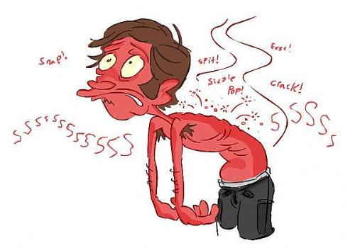 Sunburn - A little amusing cartoony thing I found with a search engine (:  Rather cute, actually.