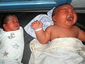 19.2 Pound Baby Boy Born in Indomesia - Mother had C-Section to deliver her 19.2 pound, 24 inch baby boy.