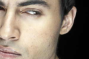 envy vs. jealousy - ...differentiate envy vs. jealousy?