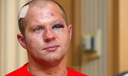 Fedor  - Fedor after fight with Cro Cop