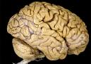 The human brain - Brain is the most important organ of human body. It is the main controlling center of humans body. It controls all the activities of other organs of the body.