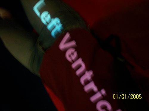 the buckety left ventricle - i was actually laying on a human heart shaped couch which randomly had the names of its chambers projected on. i decided that i want to be projected on to.
