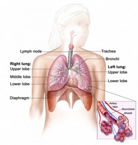 Mesothelioma Cancer - Mesothelioma is a relatively uncommon type of cancer that adversly effect the cells of the mesothelium, a protective sac that encapsulate majority of the body inner organs. To know more about Mesothelioma cancer visit http://www.simplehealthguide.com/mesothelioma-cancer/