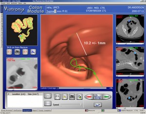 Virtual colonoscopy - A new study points to the fact that virtual colonoscopy could be a satisfactory diagnostic option to conventional colonoscopy in some though not all patients that had more than normal risk of developing colorectal cancer.