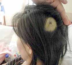 Hammered on the Head! - Fortunately there was no brain damage Hammered on the Head! - Fortunately there was no brain damage