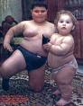 obesity - this is the photo related to obesity