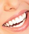 whitening of teeth - this is the photo related to teeth whitening