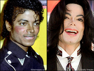 Did Michael Jackson Dye Is Skin?   Mylot