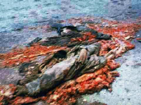 pain to extreme !!! - this guy was run over by a tank !!!!