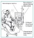 hemodialysis image - http://search.yahoo.com/search;_ylt=A0oGk04arnNLfXEBWGhXNyoA?p=hemodialysis+image&fr2=sb-top&fr=yfp-t-701&sao=1 hemodialysis image - http://search.yahoo.com/search;_ylt=A0oGk04arnNLfXEBWGhXNyoA?p=hemodialysis+image&fr2=sb-top&fr=yfp-t-701&sao=1