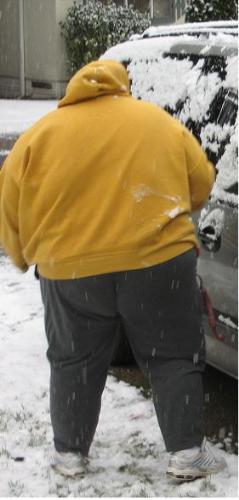 Obesity - It&#039;s hard to imagine what a 400 pounds person might look like here is a photo to give people an idea.