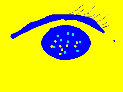 Eyeball catcher - A bright spot there under the discussion which the eyeball cannot miss.