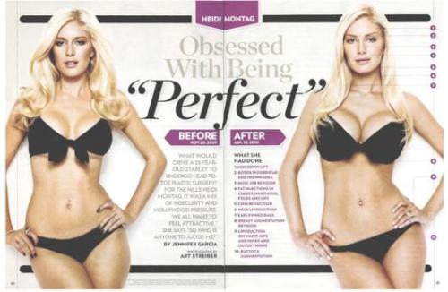 Heidi Montag Before and After - You can see the BIG difference her. Well she's happy now that's what she said.