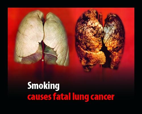 lung cancer - healthy and infected lungs