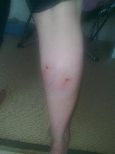 My Leg - Here is a clearer Picture then I got 