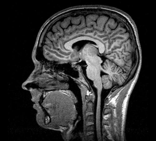 my head - this is my head. sorry. this is the think which i have on my head