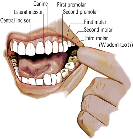Wisdom Teeth can be painful - So remove it ,some just ignore it.