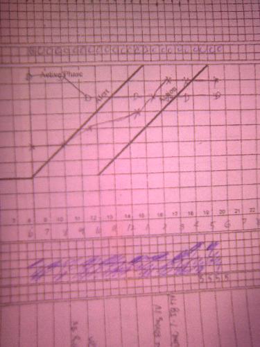 Partograph - this is a tool of obstetricians