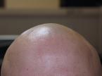 bald head - What is your impression towards anybody with a bald head?