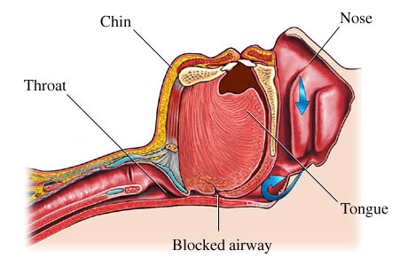 SLEEP APNEA process - yeah, sleep early SLEEP APNEA process - yeah, sleep early