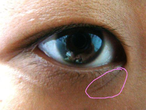 my eye - deep line under my eye. wrinkles?