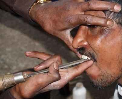 dentist in streets - road side dentists in india dentist in streets - road side dentists in india