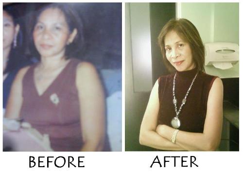 my mom - Lost 16 lbs in just 45 days  check our website: www.perfectdiet.multiply.com
