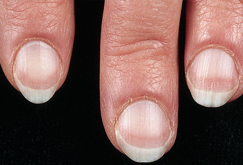 healthy nails - Nails can tell you about your health